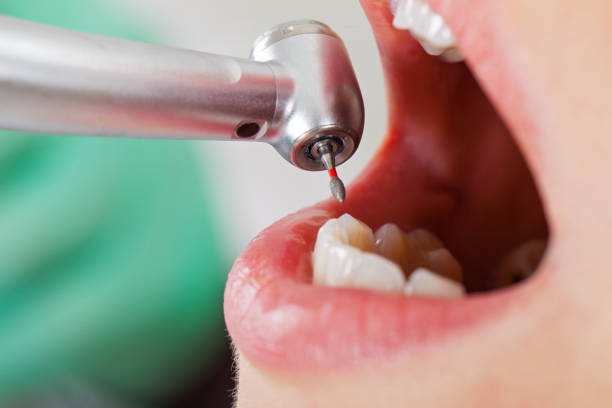 Best Cracked Tooth Emergency Dentist  in Edgewater, MD